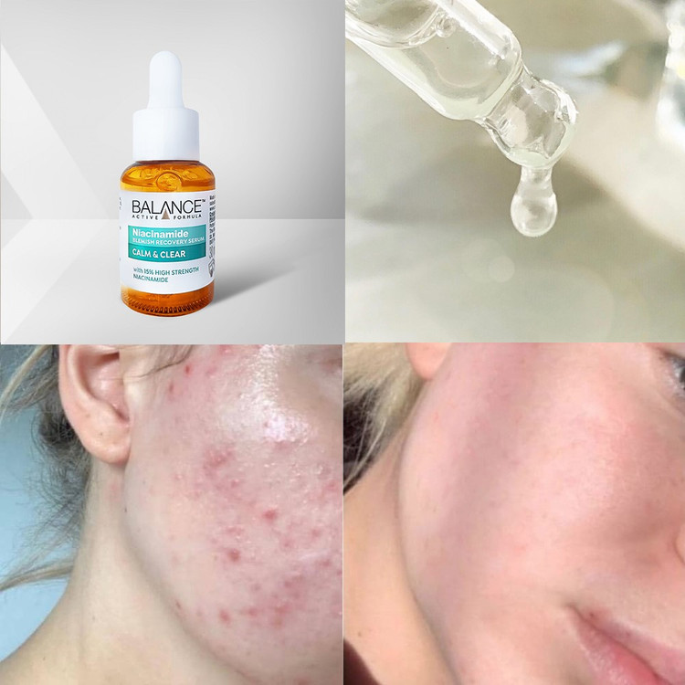 سرم نیاسینامید 15% بالانس Balance Niacinamide اصل انگلیس | ضد جوش و لک، شفاف کننده