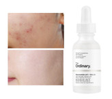 سرم نیاسینامید و زینک دی اوردینری حجم 30 میلی لیتر (ضدجوش و بهبود منافذ)