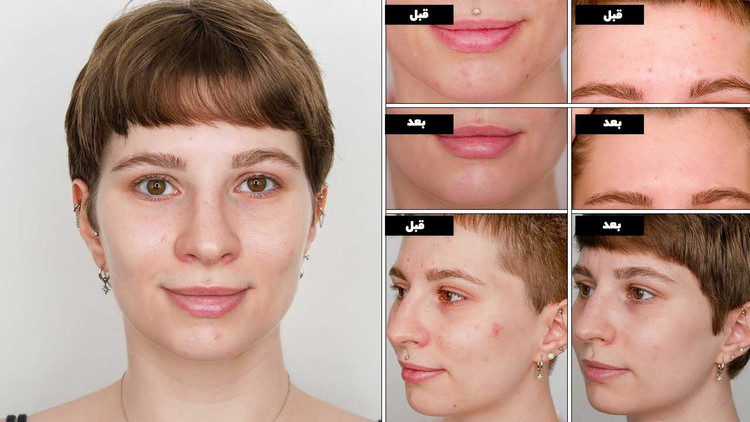 سرم آسکوربیک اسید (ویتامین سی) + آلفا آربوتین اوردینری