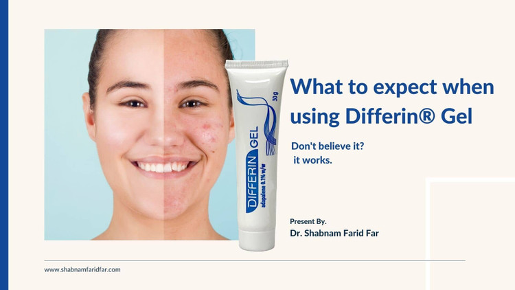 خرید ژل ضد جوش دیفرین Differin Gel 0.1 درصد اصل با بهترین قیمت