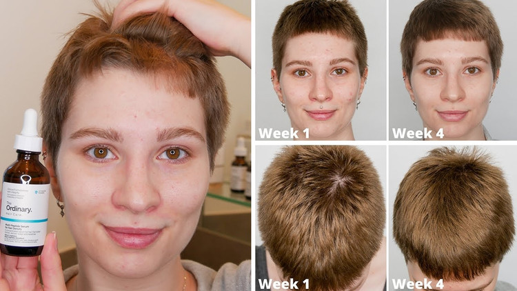 سرم مولتی پپتید اوردینری افزایش تراکم و ضد ریزش مو