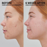 سرم روشن کننده آلفا آربوتین اینکی لیست