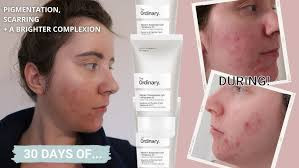 کرم سوسپانسیون ویتامین سی 23% + هیالورونیک اسید 2% اوردینری حجم 30 میلی لیتر