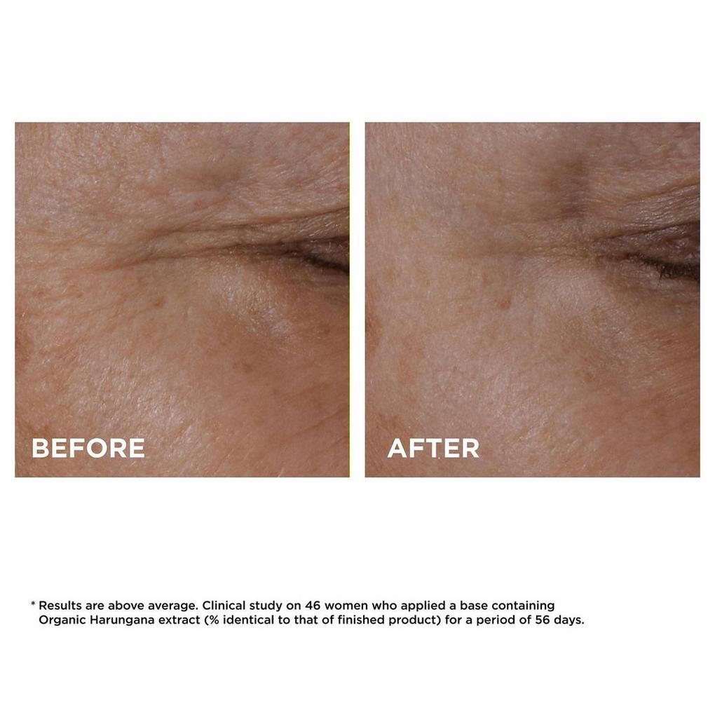 کنسانتره لیفت دور چشم Total Eye Lift کلارنس