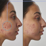 سرم رتینول ضد چروک و ضدلک ۱ ٪ اینکی لیست SUPER SOLUTIONS