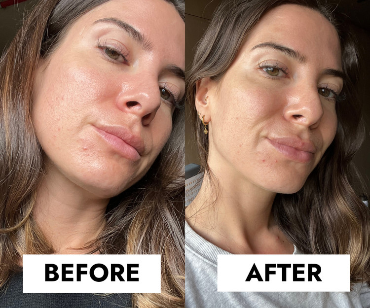 ژل شستشو سراوی CeraVe مدل Blemish Control (کنترل جوش و چربی )