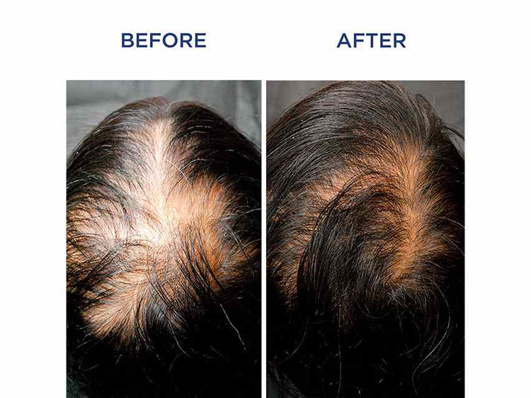 شامپو فیتوسیان ضد ریزش موی بانوان و آقایان