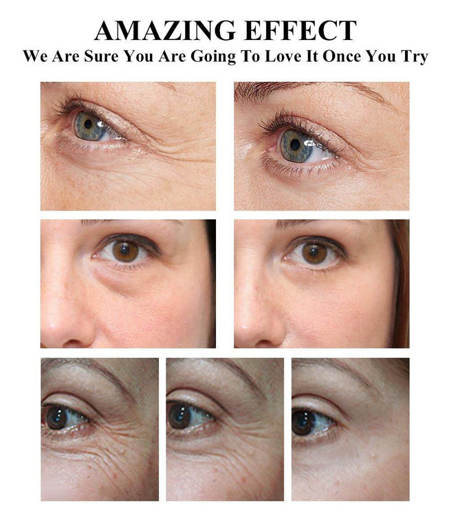 سرم دور چشم ضدچروک ، ضد تیرگی رتینال و جنسینگ بیوتی اف جوسان