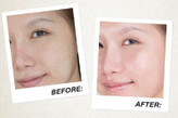 آمپول سرم روشن کننده و ضد لک Tone Brightening اسکین 1004 حجم 100
