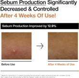 تونر روشن کننده و آبرسان برنج آنوا Anua Rice 70