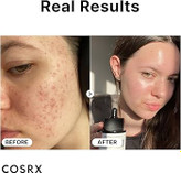 سرم نیاسینامید 15 درصد کوزارکس Cosrx ضدلک و ضد جوش