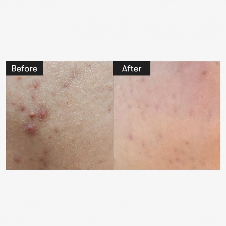 تجربه کاربران از سرم ریدل شات وی تی کازمتیکس برای جوانسازی پوست