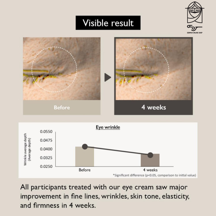 خرید کرم دور چشم باکوچیول و برنج سیاه هارو هارو