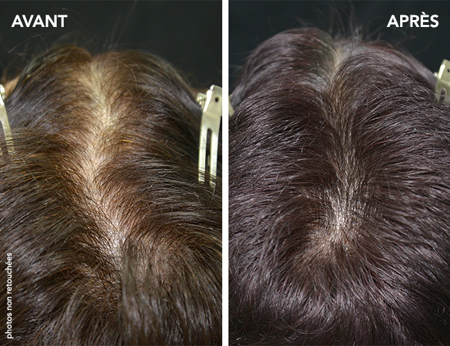 قیمت قرص فیتوسیان