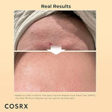 خرید اسنس حلزون کوزارکس