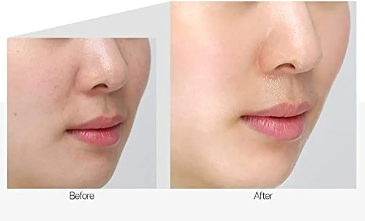 خرید کرم شب سوپر کلاژن مدی پیل اصل کره، ضد چروک، جوانساز و آبرسان پوست صورت - Medi-Peel Collagen Super 10 حجم 70 میل