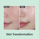 استفاده از اسنس ۹ پپتاید و سیکا برای جوانسازی و روشنکنندگی پوست