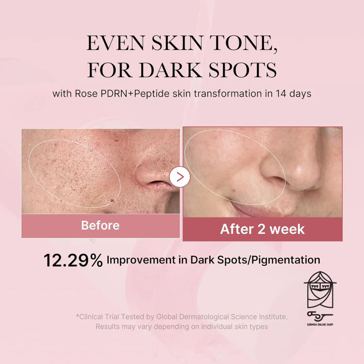 خرید تونر کلاژن و پپتید مدیکیوب اصل کرهای با ترکیب PDRN | بهترین تونر ضدچروک و روشنکننده پوست medicube