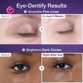 خرید کرم نامبوزین شماره ۹ حجمدهنده و لیفتینگ حاوی NAD+ و رتینول