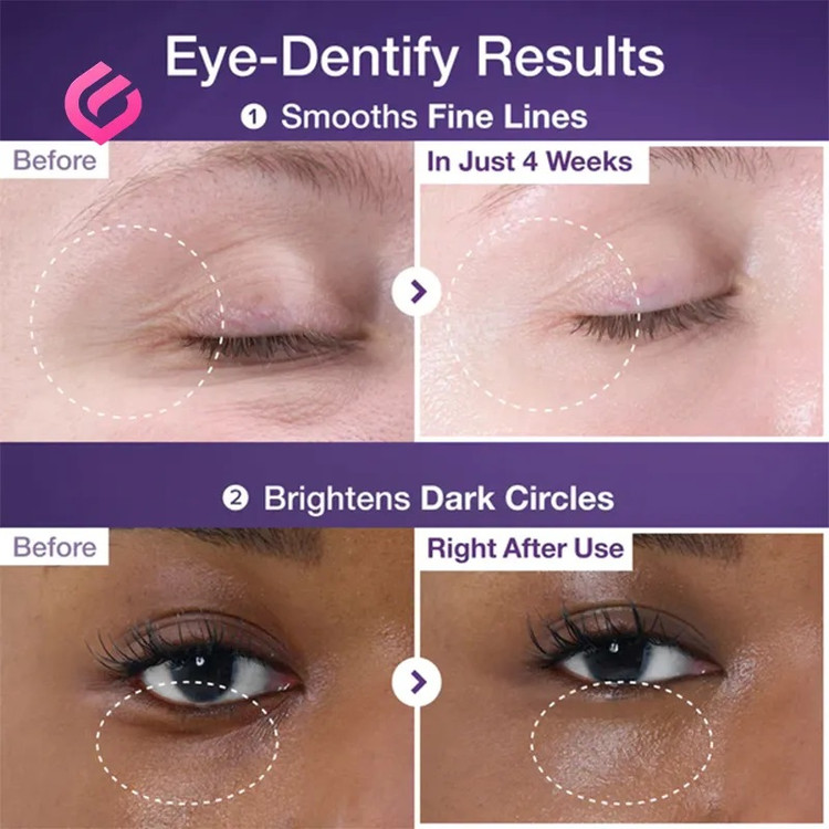 خرید کرم نامبوزین شماره ۹ حجمدهنده و لیفتینگ حاوی NAD+ و رتینول