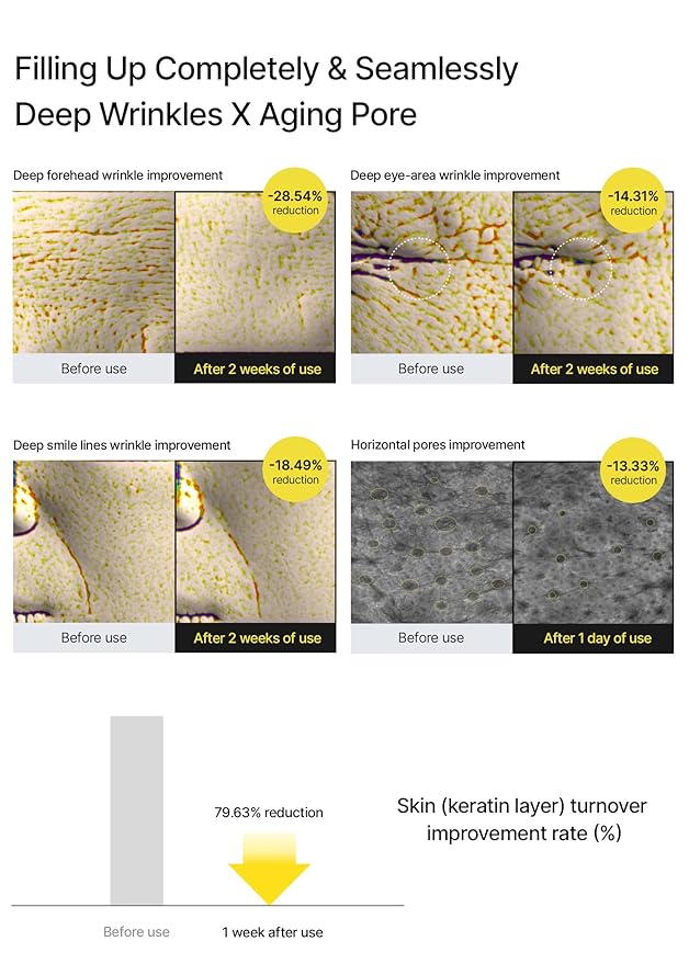 نحوه مصرف رتینال سلِمکس A-Shot — دوز نخود یک شب در میان، افزایش بعد از سه هفته؛ ضدچروک و بازسازی پوست حساس، تولید کره‌ای اصل، همراه محافظت ضدآفتاب.
