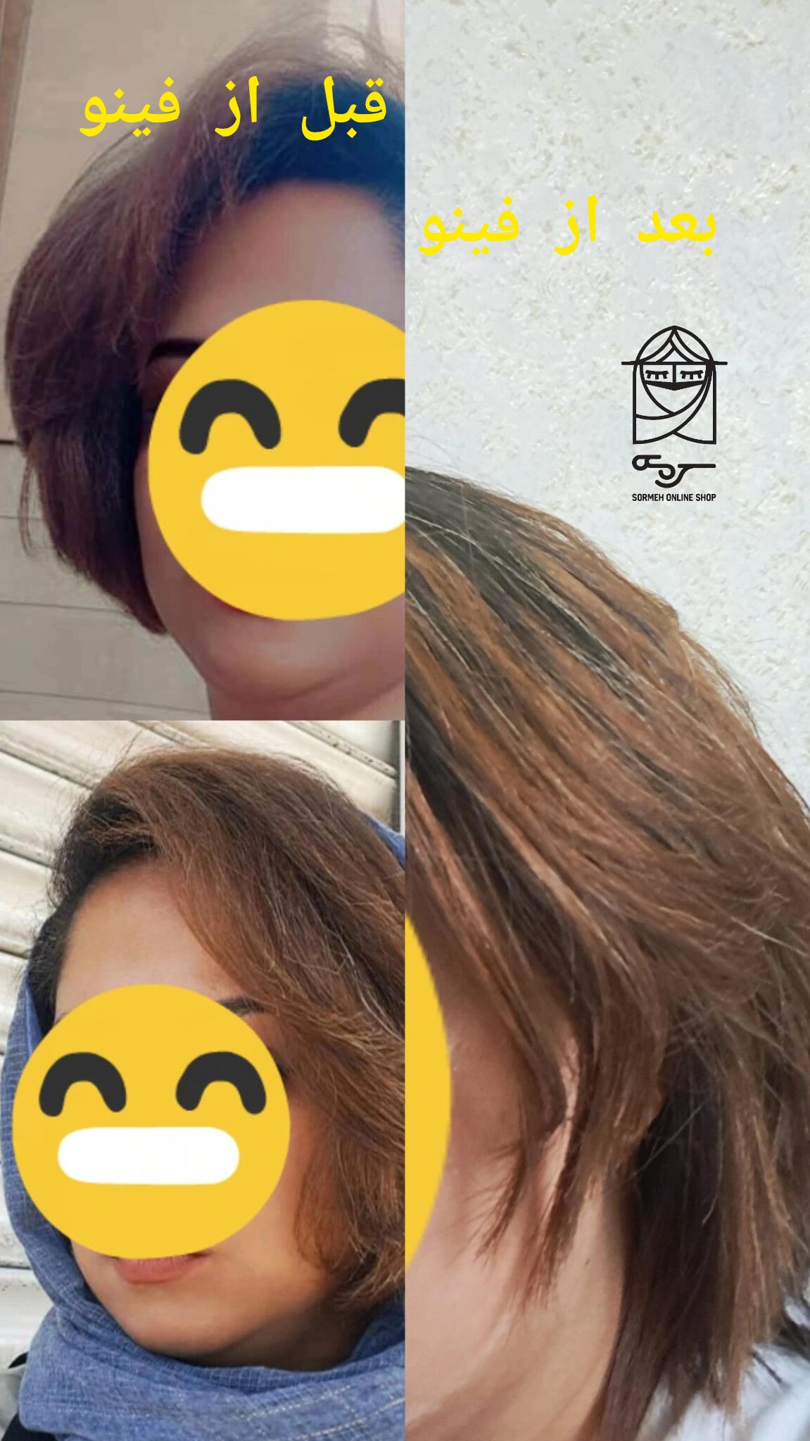 قبل و بعد ماسک مو فینو