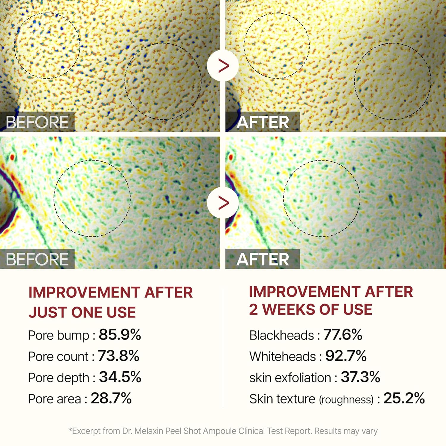 بهترین آمپول پیل شات برنج برای خرید؛ مناسب پوست‌های حساس و جوش‌دار بدون ایجاد سوزش و قرمزی