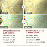 بهترین آمپول پیل شات برنج برای خرید؛ مناسب پوستهای حساس و جوشدار بدون ایجاد سوزش و قرمزی