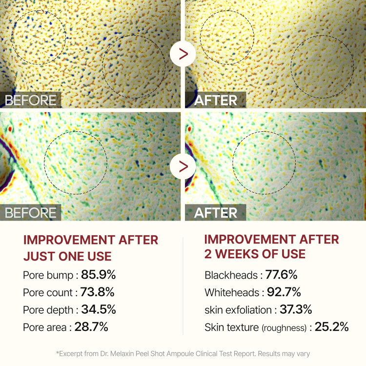 بهترین آمپول پیل شات برنج برای خرید؛ مناسب پوستهای حساس و جوشدار بدون ایجاد سوزش و قرمزی