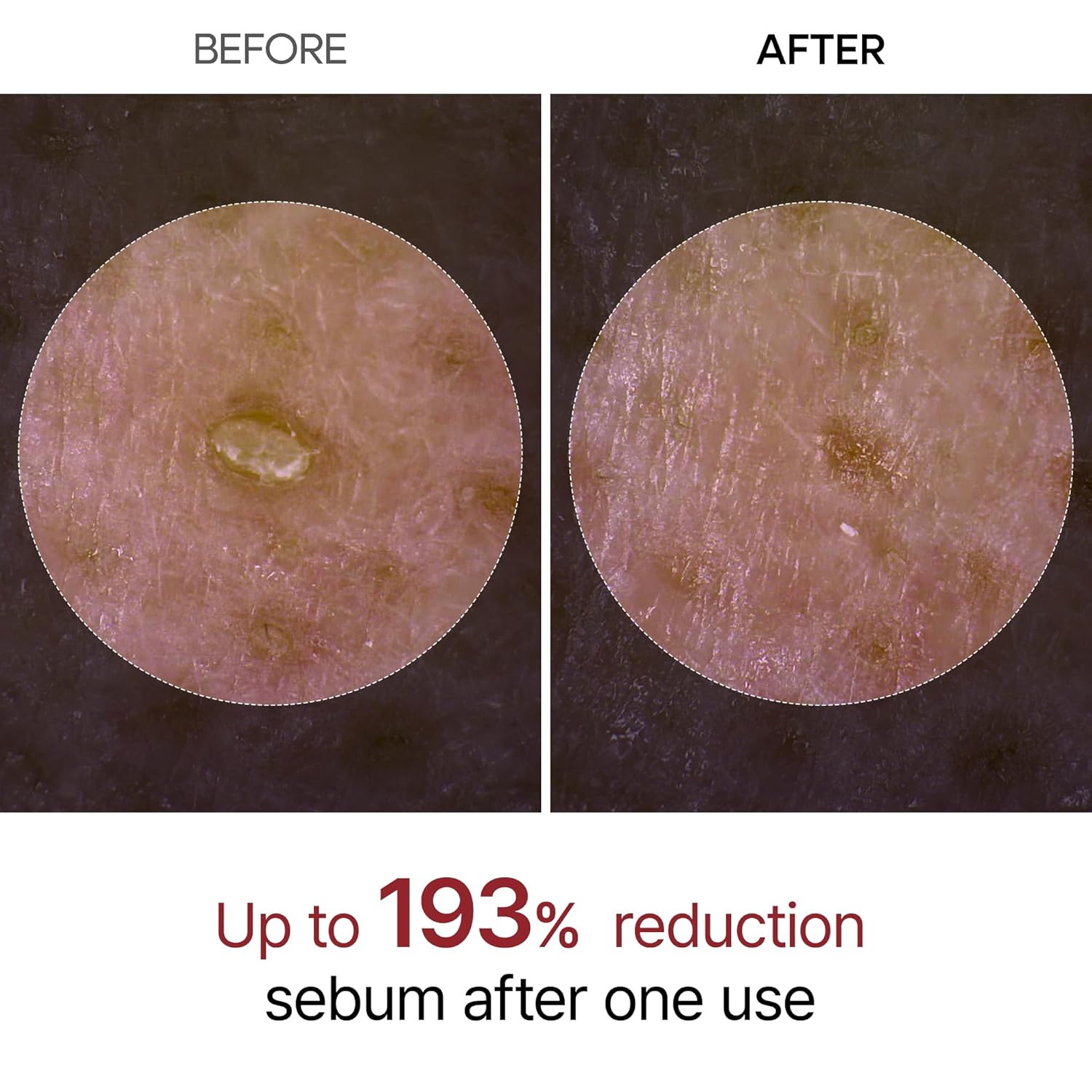 آمپول Dr. Melaxin Peel Shot مدل Glow White Rice لایه‌بردار خانگی برای درخشان شدن و کوچک کردن منافذ