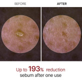 آمپول Dr. Melaxin Peel Shot مدل Glow White Rice لایهبردار خانگی برای درخشان شدن و کوچک کردن منافذ