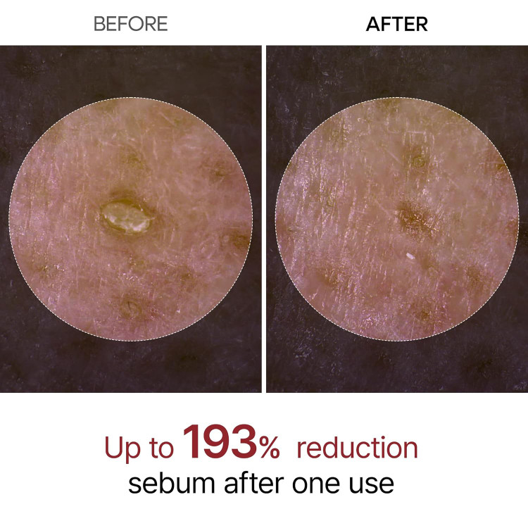 آمپول Dr. Melaxin Peel Shot مدل Glow White Rice لایهبردار خانگی برای درخشان شدن و کوچک کردن منافذ