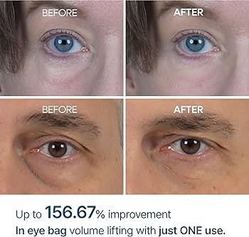 Dr.Melaxin Eyephalt Eyebag Cream کرم تخصصی کاهش پف زیر چشم با تکنولوژی Eyephalt کره‌ای