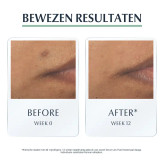 Eucerin DermoPure Triple Effect Serum درمان لک آکنه و مات کننده