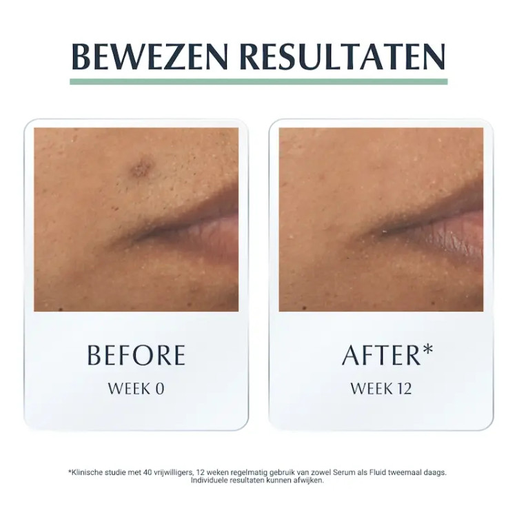 Eucerin DermoPure Triple Effect Serum درمان لک آکنه و مات کننده