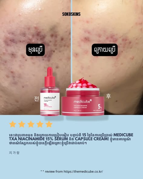 نحوه استفاده از کرم کپسولی Medicube برای ساخت پوست شیشهای و شفاف با ترکیب ژل و کپسول