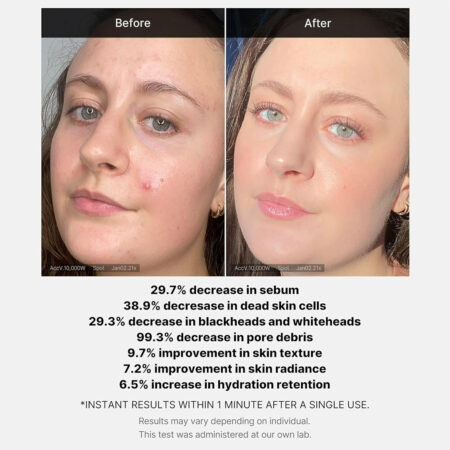 سرم ۱ دقیقهای Medicube مدل Red Acne حاوی لاکتیک و سالیسیلیک اسید