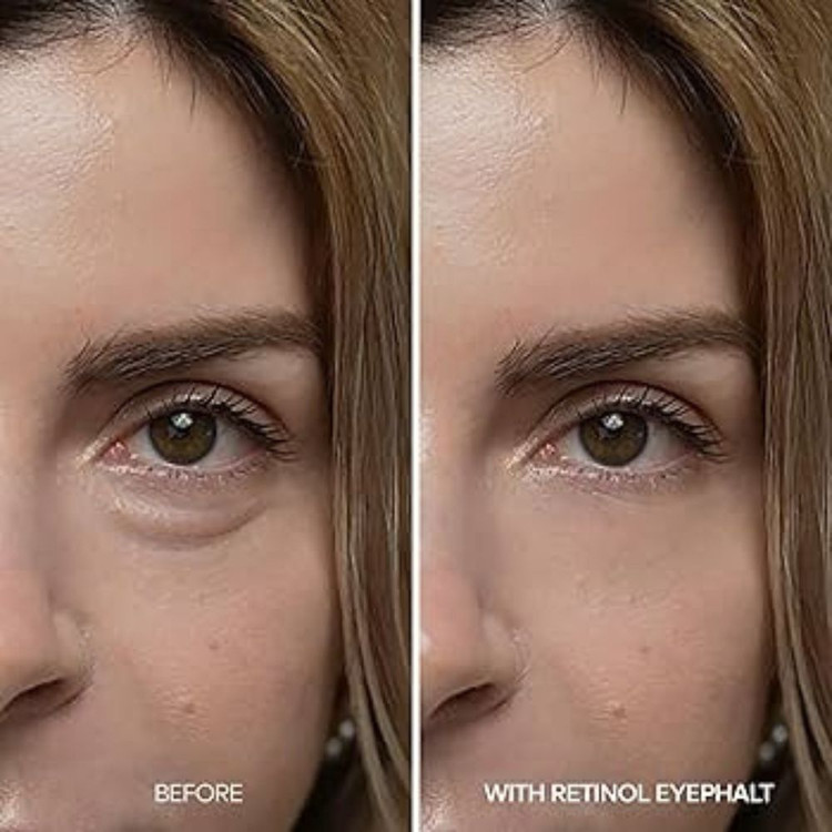 کرم دور چشم رتینول Dr.Melaxin اصل برای رفع پف و چروک دور چشم