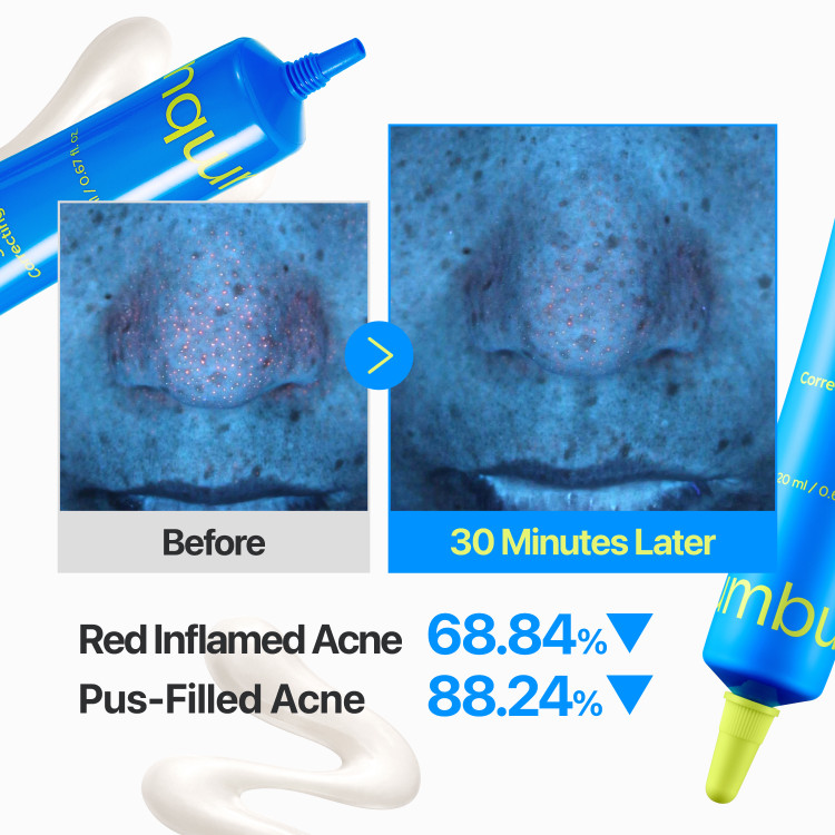 تاثیر کرم ضد لک نامبوزین No.0 Zero Blemish 3X