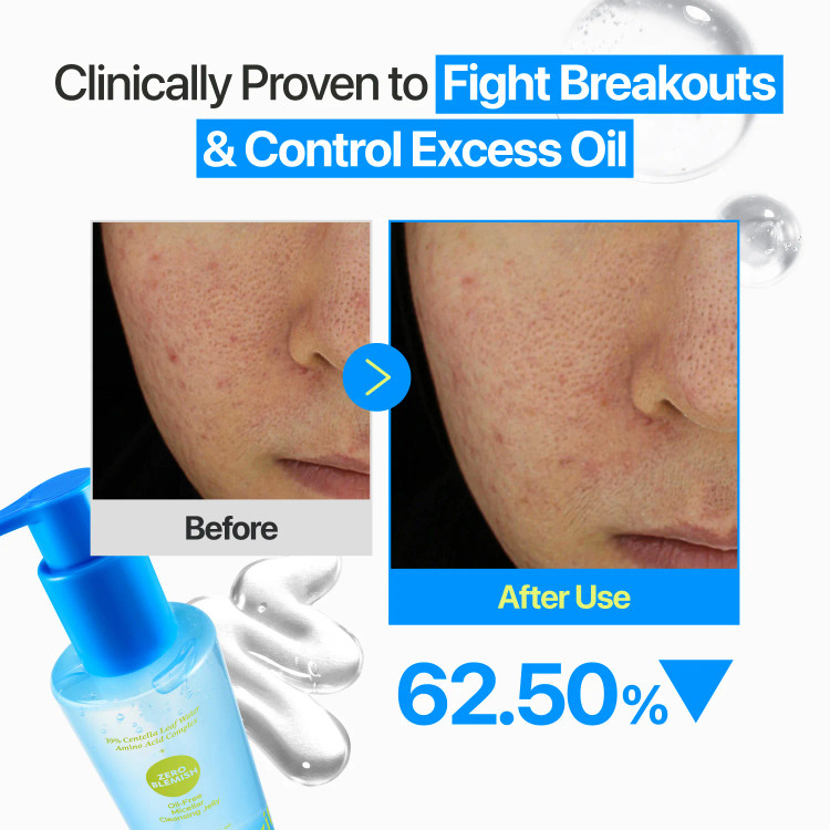 ژل پاک کننده نامبوزین Zero Blemish میسلار بدون روغن 200 میلی لیتر